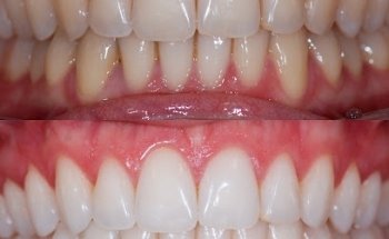 Dentalrambla