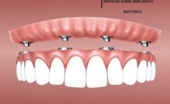 RAPIDENT CLINICA DENTAL