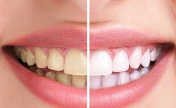 Clínica Dental MUNDISALUD