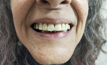 Esteticdent