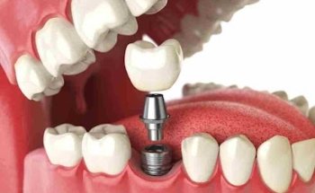 CLINICA DENTAL MARIA JOSE MONTENEGRO
