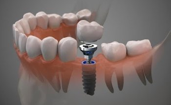 Instituto Bucodental Selas y Carrero Alcorcón