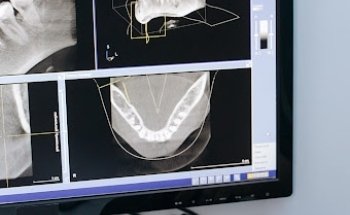 Implantes Dentales Irun
