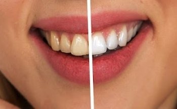 Clínica Dental Jesús Bilbao Anitua
