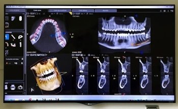 Clínica Dental Dr. Pompeyo - Acueducto