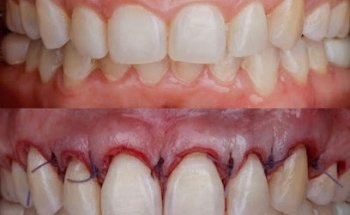 Easy Dental