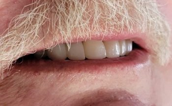 Loreto dental