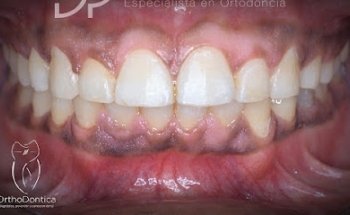 OrthoDontica Clinica Dental
