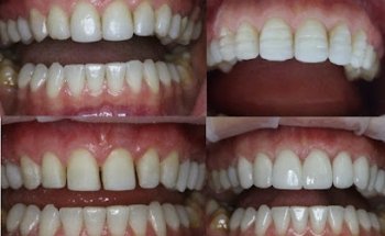 Dental Marbella