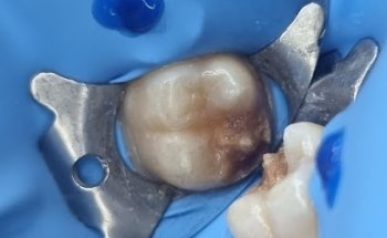 Cabo Smile Design, Odontologia Familiar.