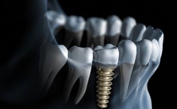 DENTALUX.Mx