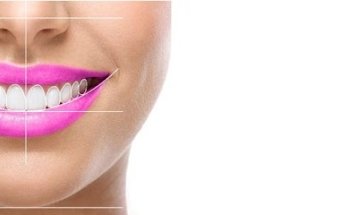 Smile Dental