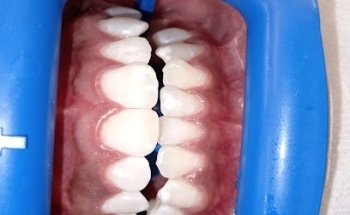 Consultorio Dental Excellence
