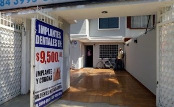 Implantes dentales