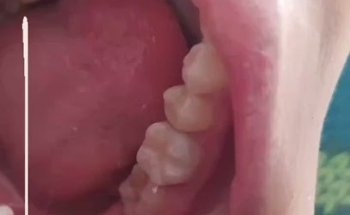 Dental Romero