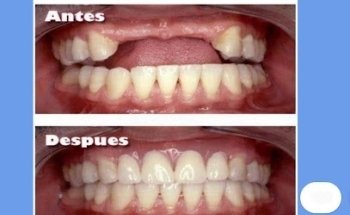 Laboratorio Dental New-Dent's