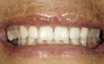 Town Dental