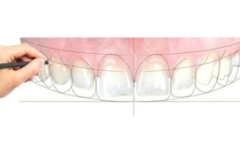 Crystal Smiles Clinic Ltd