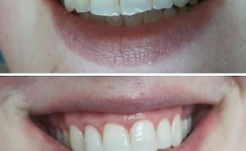 KBM Dental Rathfarnham