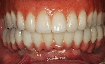 Brecknock Dental