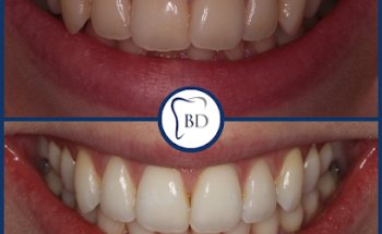 Bewdley Dental Practice & Implant Centre