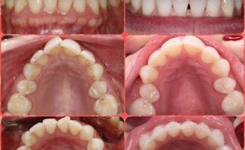 Smile 4 U - Bromley
