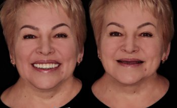 Complex Smile implant centre