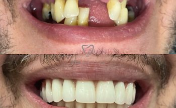 Pro Dental Clinic