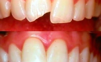 Family Dental Care