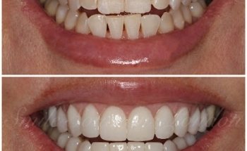 Smile Solutions