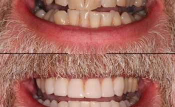 The Smile Gallery