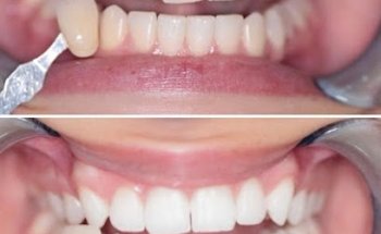 Carlton Dental Practice