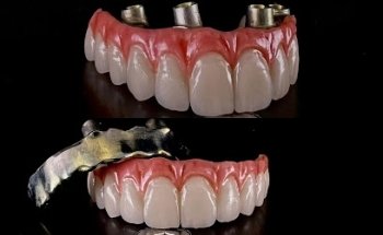 Clínica Fusión Dental