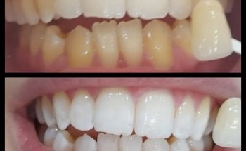 Andover Advanced Dental Centre