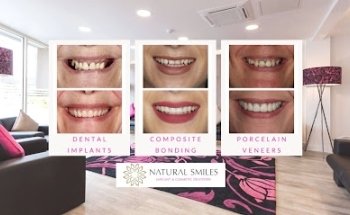 Natural Smiles Leicester
