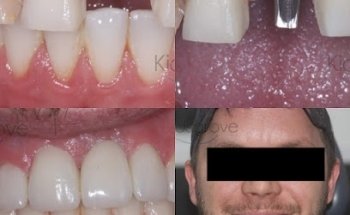 Kidsgrove Dental & Implant Centre | Dentist Stoke-on-Trent