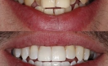 Aromaden Dental and Implant Clinic