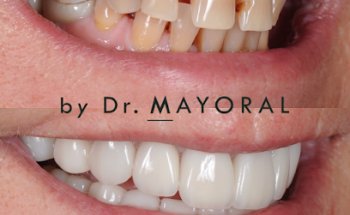 Barcelona Smile Center - Estética Dental