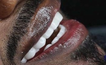 Dental Design Smile