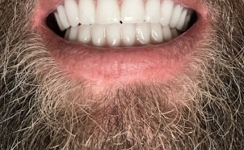 Lake Whitney Dental