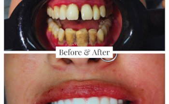 Georgetown Elite Dental & Implant Center