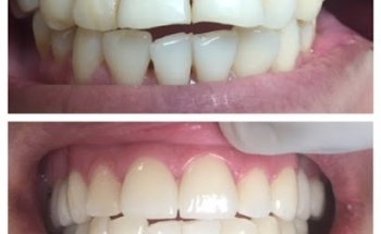 PhD Dental Boyle Heights Los Angeles Adults, Kids, Wisdom Teeth & Braces