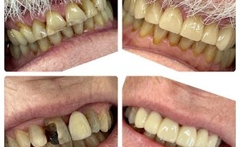 Hampton Dentist - Smiles by The Sea