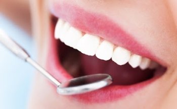 Lumineers Sevilla | Estética Dental Sevilla