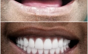 Wow Dental