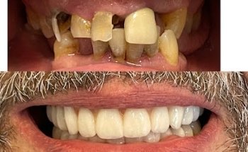 Salvatore Dental