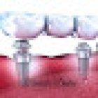Maikol's dental